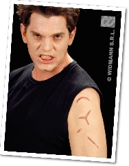 Heridas cortes